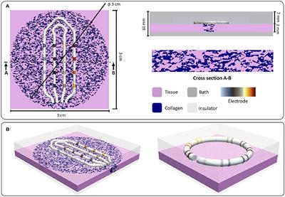 Using Machine Learning to Characterize Atrial Fibrotic Substrate From Intracardiac Signals With a Hybrid in silico and in vivo Dataset